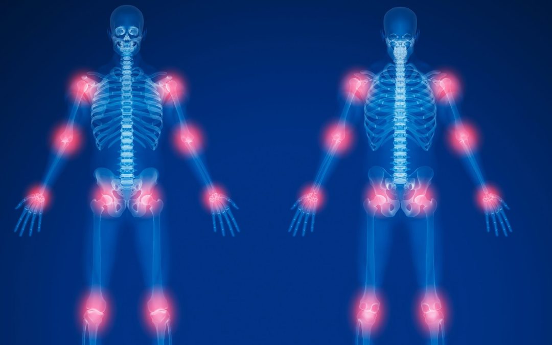 Why is my Arthritis Worse on One Side? (Three Reasons)
